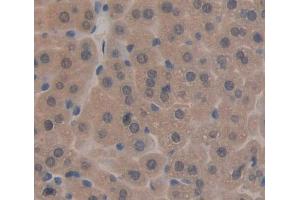 Used in DAB staining on fromalin fixed paraffin- embedded liver tissue (TAT Antikörper  (AA 190-454))