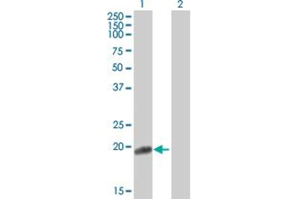 Fibronectin 1 Antikörper  (AA 1-163)