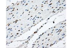 Immunohistochemistry (IHC) image for anti-Nitrilase Family, Member 2 (NIT2) antibody (ABIN1499737) (NIT2 Antikörper)