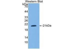 Western blot analysis of the recombinant protein. (SNRPC Antikörper  (AA 2-159))