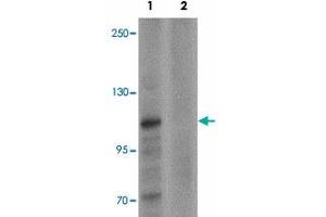 Western blot analysis of ZMIZ1 in K-562 cell lysate with ZMIZ1 polyclonal antibody  at 0. (ZMIZ1 Antikörper  (N-Term))