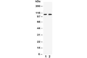 Western blot testing of EphB3 antibody and Lane 1:  HeLa (EPH Receptor B3 Antikörper  (C-Term))