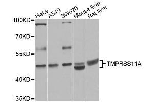 Western blot analysis of extracts of various cell lines, using TMPRSS11A antibody (ABIN5995991) at 1/1000 dilution. (TMPRSS11A Antikörper)