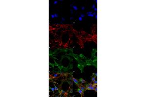 Immunocytochemistry/Immunofluorescence analysis using Mouse Anti-Acrolein Monoclonal Antibody, Clone 10A10 . (Acrolein Antikörper  (Atto 488))