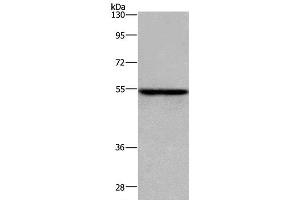 Western Blot analysis of MCF-7 cell using ETS2 Polyclonal Antibody at dilution of 1:300 (ETS2 Antikörper)