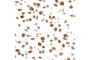 Immunocytochemistry (ICC) image for anti-Signal Transducer and Activator of Transcription 3 (Acute-Phase Response Factor) (STAT3) (AA 175-225) antibody (ABIN7455098)