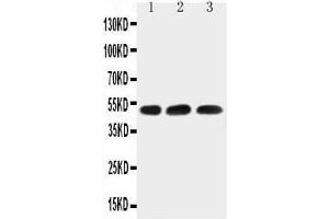 Anti-HYAL1 antibody,  Western blotting Lane 1: HELA Cell Lysate Lane 2: 22RV1 Cell Lysate Lane 3: MCF-7 Cell Lysate (HYAL1 Antikörper  (N-Term))