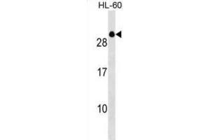 Western Blotting (WB) image for anti-Transcription Elongation Factor A (SII)-Like 2 (TCEAL2) antibody (ABIN3000105) (TCEAL2 Antikörper)