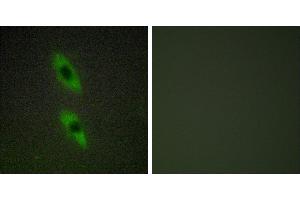Peptide - +Immunohistochemistry analysis of paraffin-embedded human liver carcinoma tissue using FADD antibody. (FADD Antikörper)