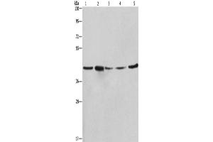Western Blotting (WB) image for anti-Ribosomal Protein SA (RPSA) antibody (ABIN2421848) (RPSA/Laminin Receptor Antikörper)