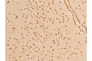 Immunohistochemistry (IHC) image for anti-Tumor Protein P73 (TP73) (pTyr99) antibody (ABIN6256817)