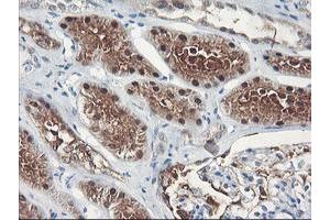 Immunohistochemical staining of paraffin-embedded Human Kidney tissue using anti-FBXO21 mouse monoclonal antibody. (FBXO21 Antikörper)