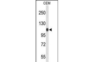 Western blot analysis of IPO11 Antibody (C-term) (ABIN653614 and ABIN2842973) in CEM cell line lysates (35 μg/lane). (Importin 11 Antikörper  (C-Term))
