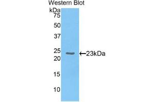Detection of Recombinant CBX3, Human using Polyclonal Antibody to Chromobox Homolog 3 (CBX3) (CBX3 Antikörper  (AA 1-183))