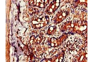 Immunohistochemistry of paraffin-embedded human small intestine tissue using ABIN7147277 at dilution of 1:100 (CIDEB Antikörper  (AA 80-145))