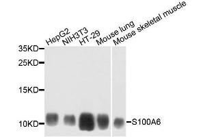 Western blot analysis of extracts of various cell lines, using S100A6 antibody.