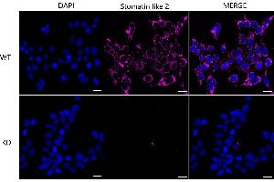 Immunocytochemical staining of HeLa cells using Stomatin like 2 antibody (ABIN7800442), 1:1,000), Top panel: wild-type (WT), Bottom panal: Stomatin like 2 shRNA knockdown (KD). (Rekombinanter STOML2 Antikörper)