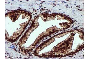 Image no. 3 for anti-EPM2A (Laforin) Interacting Protein 1 (EPM2AIP1) antibody (ABIN1498045) (EPM2AIP1 Antikörper)