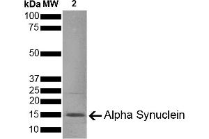 SDS-PAGE of ~14 kDa Type 1 Mouse Recombinant Alpha Synuclein Protein Pre-formed Fibrils (ABIN5651245, ABIN5651246 and ABIN5651247). (SNCA Protein (full length))