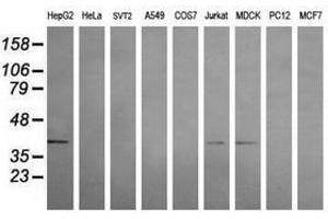 Image no. 2 for anti-Mitogen-Activated Protein Kinase Kinase 3 (MAP2K3) antibody (ABIN1499416) (MAP2K3 Antikörper)