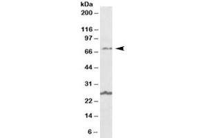 Western blot testing of human olfactory bulb lysate with SLC6A12 antibody at 1ug/ml. (SLC6A12 Antikörper)