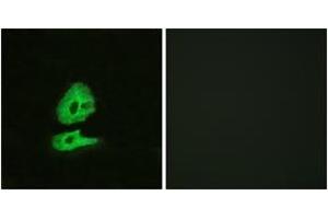 Immunofluorescence analysis of HeLa cells, using GLR Antibody. (GLRa2 Antikörper  (AA 95-144))