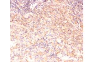 IHC-P: IKK alpha antibody testing of rat spleen tissue (IKK alpha Antikörper  (AA 411-745))