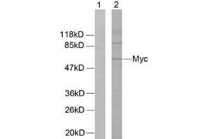 Western blot analysis of extracts from ovary cancer cells using Myc (Ab-58) antibody (E021034). (c-MYC Antikörper)