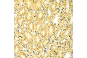 Immunohistochemistry (IHC) image for anti-phosphodiesterase 4D Interacting Protein (PDE4DIP) antibody (ABIN2737336)