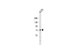 Anti-SRPK1 Antibody (N-term)at 1:1000 dilution +  whole cell lysate Lysates/proteins at 20 μg per lane. (SRPK1 Antikörper  (C-Term))