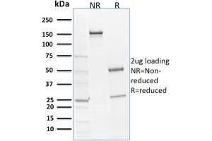 SDS-PAGE Analysis Purified SOX9 Mouse Monoclonal Antibody (SOX9/2398).