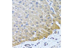 Immunohistochemistry of paraffin-embedded human liver using ARSF antibody at dilution of 1:100 (40x lens). (ARSF Antikörper)