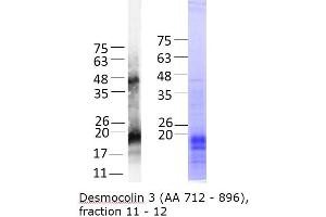 Image no. 2 for Desmocollin 3 (DSC3) (AA 712-896) protein (His tag) (ABIN3079072) (Desmocollin 3 Protein (DSC3) (AA 712-896) (His tag))