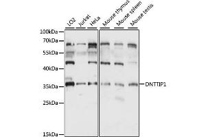 Western blot analysis of extracts of various cell lines, using DNTTIP1 antibody (ABIN7266731) at 1:1000 dilution. (DNTTIP1 Antikörper  (AA 1-329))