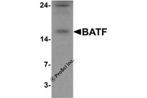 Western Blotting (WB) image for anti-Basic Leucine Zipper ATF-like Transcription Factor (BATF) (N-Term) antibody (ABIN1077388) (BATF Antikörper  (N-Term))