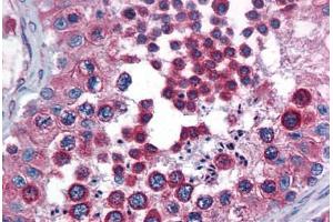 Human Testis: Formalin-Fixed, Paraffin-Embedded (FFPE) (Calnexin Antikörper  (AA 204-218))