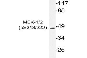 Western blot (WB) analyzes of p-MEK-1/2 antibody in extracts from 293 PMA cells. (MEK1 Antikörper  (pSer218, pSer222))
