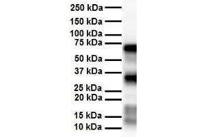 WB Suggested Anti-SLC25A12 antibody Titration: 1 ug/mL Sample Type: Human heart (SLC25A12 Antikörper  (Middle Region))