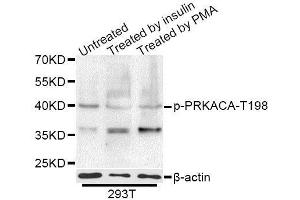 Western blot analysis of extracts of 293T cells,using Phospho-PRKACA-T197 antibody (ABIN5995920) at 1/1000 dilution. (PRKACA Antikörper  (pThr198))