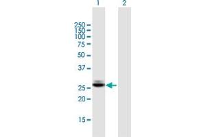Western Blot analysis of CTRB1 expression in transfected 293T cell line by CTRB1 MaxPab polyclonal antibody. (CTRB1 Antikörper  (AA 1-263))
