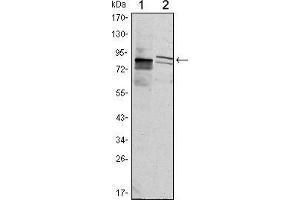 Western blot analysis using KLHL11 mouse mAb against Hela (1) and MCF-7 (2) cell lysate. (KLHL11 Antikörper)