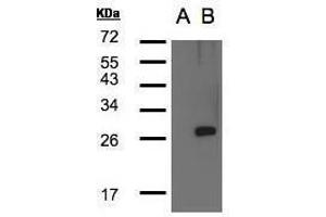 WB Image Western Blot analysis of LYPLA1 expression in transfected 293T cell line by LYPLA1polyclonal antibody. (LYPLA1 Antikörper)