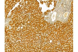 ABIN6265416 and ABIN6273079 at 1/100 staining Human normal tissues adjacent to liver cancer by IHC-P.