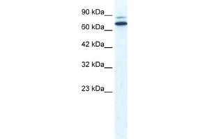 WB Suggested Anti-ZNF57 Antibody Titration:  0. (ZFP57 Antikörper  (N-Term))