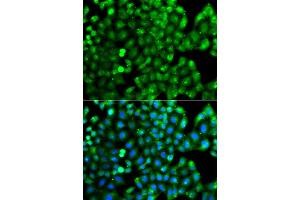 Immunofluorescence analysis of A549 cell using HLA-DRB1 antibody. (HLA-DRB1 Antikörper)