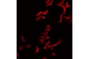 ABIN6274995 staining Hela by IF/ICC. (CBLN2 Antikörper  (N-Term))