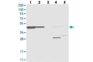 Western blot analysis of Lane 1: RT-4, Lane 2: U-251 MG, Lane 3: Human Plasma, Lane 4: Liver, Lane 5: Tonsil with OLA1 polyclonal antibody  at 1:250-1:500 dilution. (OLA1 Antikörper)