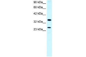 ASGR2 antibody used at 0. (Asialoglycoprotein Receptor 2 Antikörper  (N-Term))