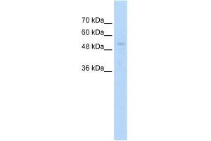 WB Suggested Anti-ARIH1 Antibody Titration:  1.