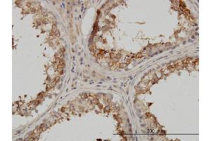 Immunostaining (ISt) image for anti-Proteasome (Prosome, Macropain) Subunit, beta Type, 4 (PSMB4) (AA 1-264) antibody (ABIN562479)